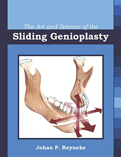 Art and Science of the Sliding Genioplasty [Paperback]