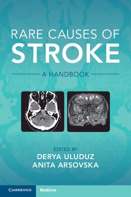 Rare Causes of Stroke: A Handbook [Paperback]