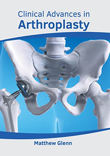 Clinical Advances in Arthroplasty [Hardcover]