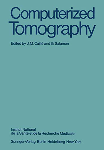 Computerized Tomography [Paperback]