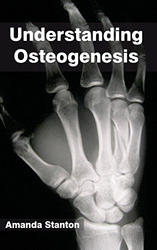 Understanding Osteogenesis [Hardcover]