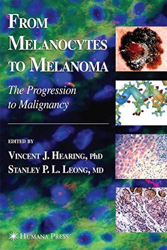 From Melanocytes to Melanoma: The Progression to Malignancy [Paperback]