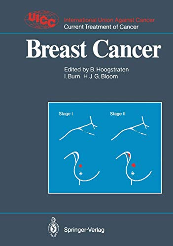 Breast Cancer [Paperback]