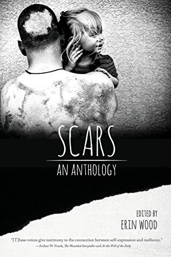 Scars An Anthology [Paperback]