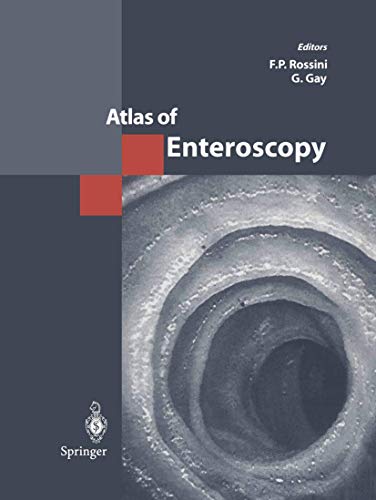 Atlas of Enteroscopy [Paperback]