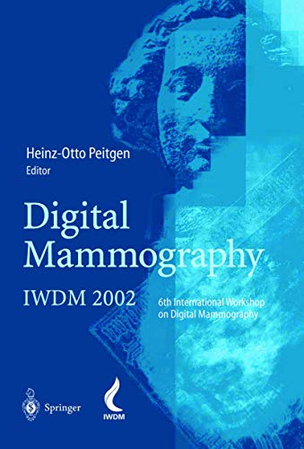 Digital Mammography: IWDM 2002  6th International Workshop on Digital Mammograp [Paperback]