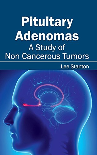 Pituitary Adenomas A Study Of Non Cancerous Tumors [Hardcover]