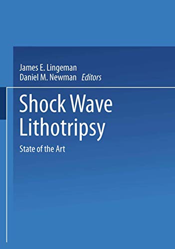 Shock Wave Lithotripsy: State of the Art [Paperback]