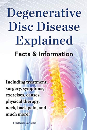 Degenerative Disc Disease Explained. Including Treatment, Surgery, Symptoms, Exe [Paperback]