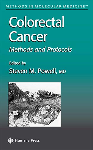 Colorectal Cancer: Methods and Protocols [Hardcover]