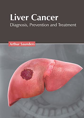 Liver Cancer Diagnosis, Prevention And Treatment