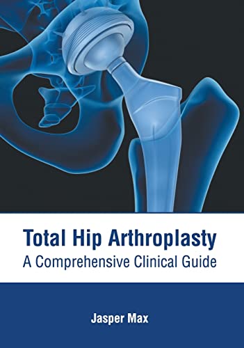 Total Hip Arthroplasty A Comprehensive Clinical Guide [Hardcover]