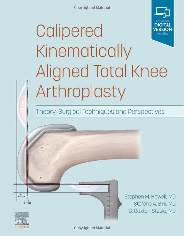 Calipered Kinematically aligned Total Knee Arthroplasty: Theory, Surgical Techni [Hardcover]