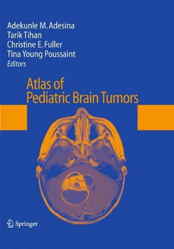 Atlas of Pediatric Brain Tumors [Hardcover]