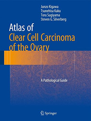 Atlas of Clear Cell Carcinoma of the Ovary: A Pathological Guide [Hardcover]