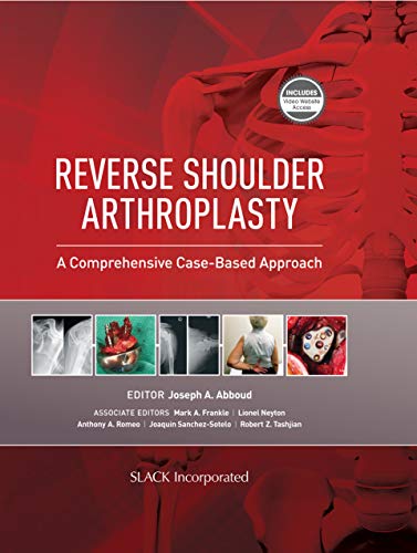 Reverse Shoulder Arthroplasty: A Comprehensive Case-Based Approach [Hardcover]