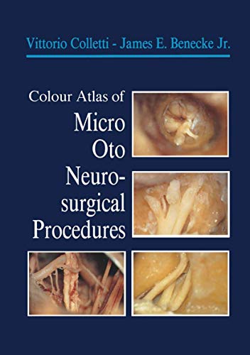 Colour Atlas of Micro-Oto-Neurosurgical Procedures [Paperback]