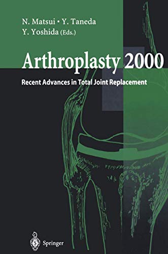 Arthroplasty 2000: Recent Advances in Total Joint Replacement [Paperback]