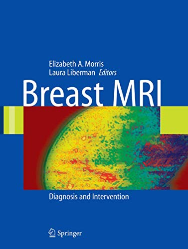 Breast MRI Diagnosis and Intervention [Hardcover]