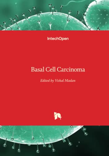 Basal Cell Carcinoma