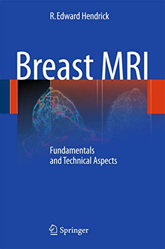 Breast MRI Fundamentals and Technical Aspects [Paperback]