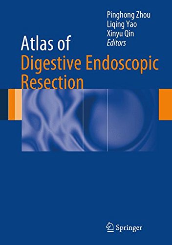 Atlas of Digestive Endoscopic Resection [Hardcover]