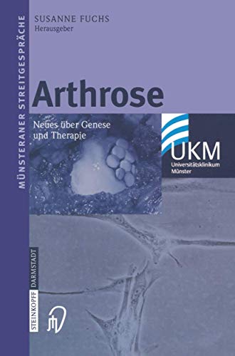 Arthrose: Neues ber Genese und Therapie [Paperback]