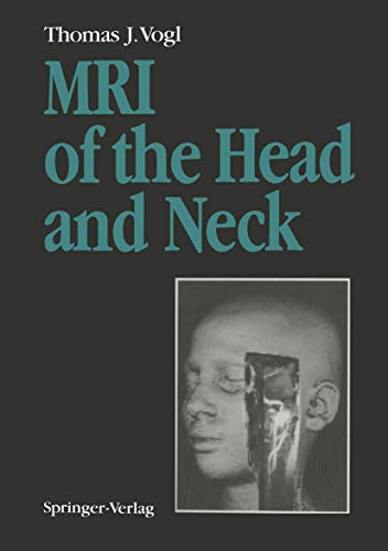 MRI of the Head and Neck Functional Anatomy  Clinical Findings  Pathology  I [Paperback]