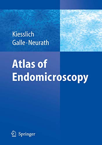 Atlas of Endomicroscopy [Paperback]