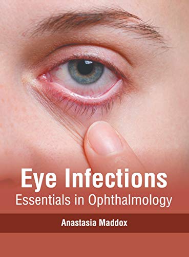 Eye Infections Essentials in Ophthalmology [Hardcover]