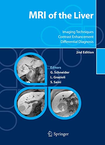 MRI of the Liver: Imaging Techniques, Contrast Enhancement, Differential Diagnos [Paperback]