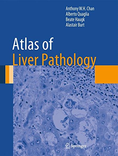 Atlas of Liver Pathology [Hardcover]