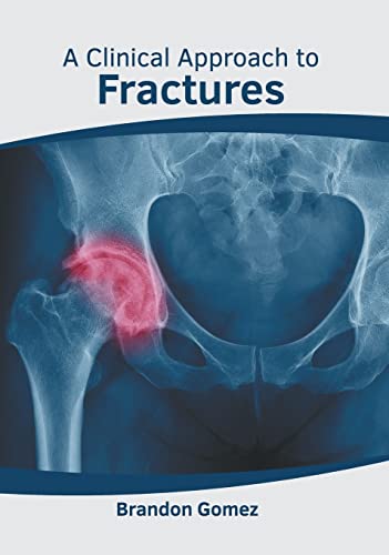 A Clinical Approach to Fractures [Hardcover]