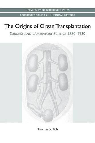 The Origins of Organ Transplantation Surgery and Laboratory Science, 1880-1930 [Paperback]