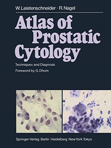 Atlas of Prostatic Cytology: Techniques and Diagnosis [Paperback]