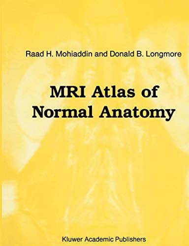 MRI Atlas of Normal Anatomy [Paperback]