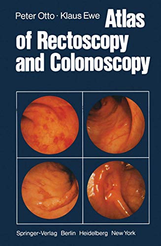 Atlas of Rectoscopy and Coloscopy [Paperback]