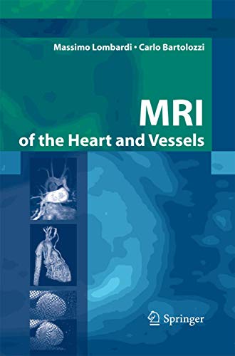 MRI of the Heart and Vessels [Paperback]