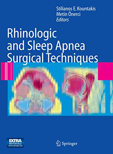 Rhinologic and Sleep Apnea Surgical Techniques [Paperback]