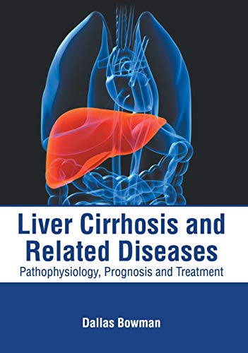 Liver Cirrhosis and Related Diseases Pathophysiology, Prognosis and Treatment [Hardcover]