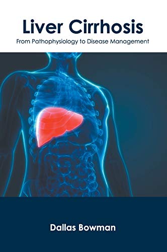 Liver Cirrhosis From Pathophysiology to Disease Management [Hardcover]