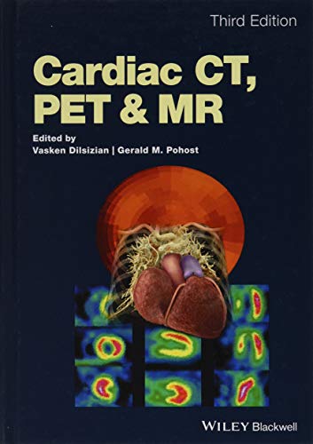 Cardiac CT, PET and MR [Hardcover]