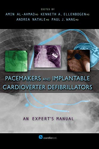 Pacemakers and Implantable Cardioverter Defibrillators An Expert&aposs Manual [Hardcover]