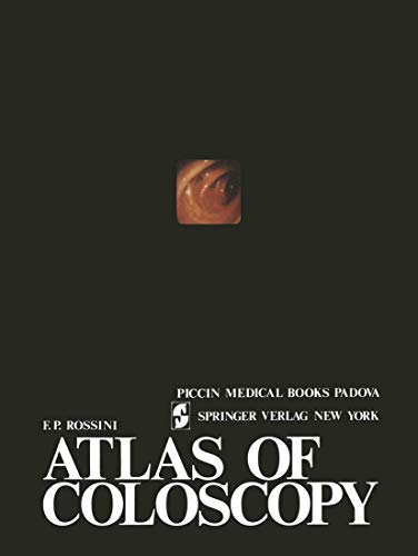 Atlas of coloscopy [Paperback]