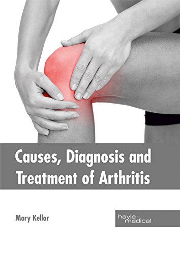 Causes, Diagnosis And Treatment Of Arthritis [Hardcover]