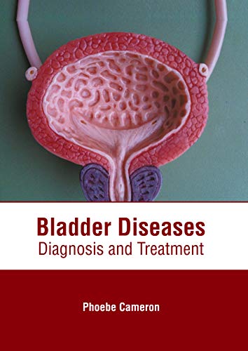 Bladder Diseases Diagnosis and Treatment [Hardcover]