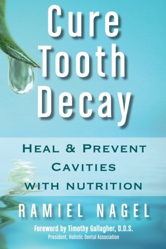 Cure Tooth Decay Heal And Prevent Cavities With Nutrition, Second Edition [Paperback]