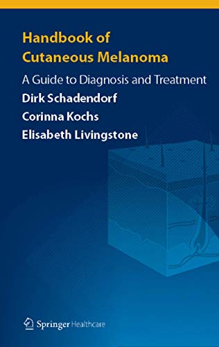 Handbook of Cutaneous Melanoma A Guide to Diagnosis and Treatment [Paperback]