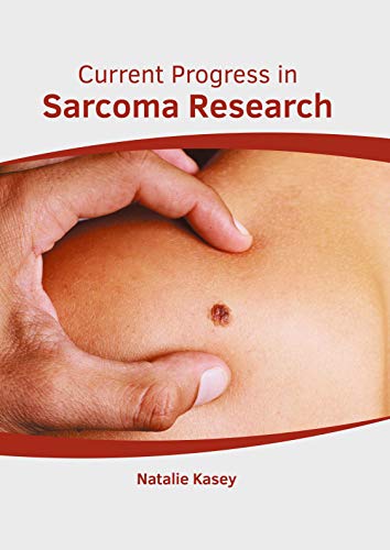 Current Progress in Sarcoma Research [Hardcover]