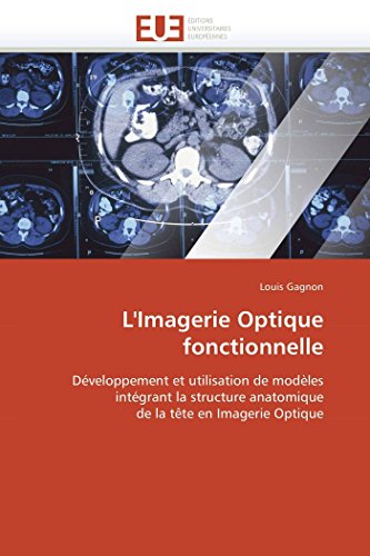 L'imagerie Optique Fonctionnelle Dveloppement Et Utilisation De Modles Intgr [Paperback]